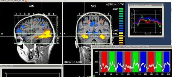 What is fMRI ?