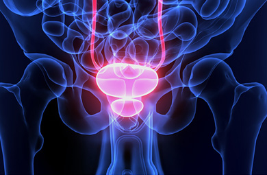 ONCOLOGY, symptoms of fallen bladder, MRI-Post Processing Applications
