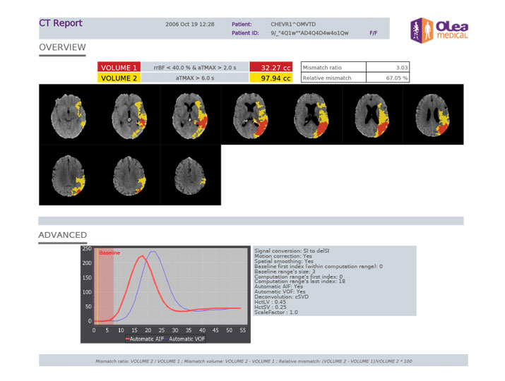 Olea Medical-Neurology, Kryptonite solutions