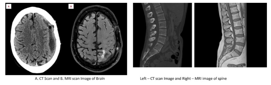 example of CT Scan and MRI Scan