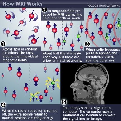 How MRI works