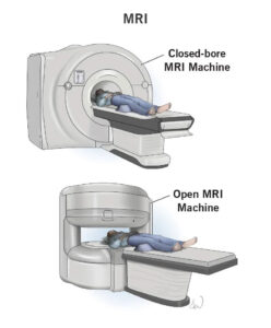 Open-bore-MRI