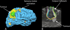 fMRI innovative techniques