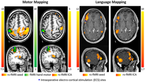 mapping brain activity