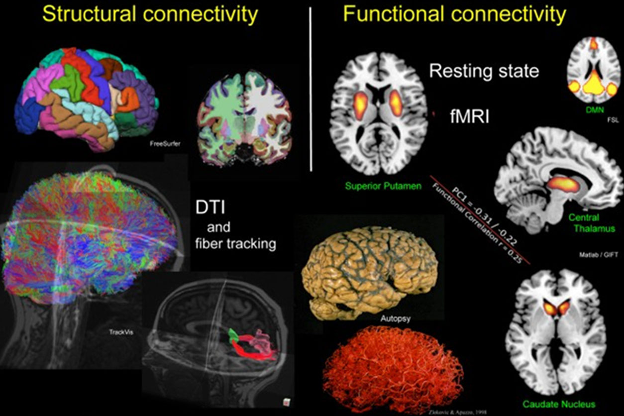 How fMRI is revolutionizing Neuroscience research?, Kryptonite solutions