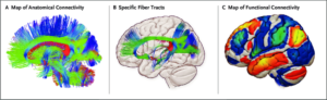 The Role of FMRI in Diagnosing and Treating Mental Health Disorders-Kryptonite Blog
