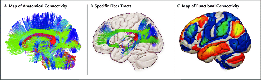 The Role of FMRI in Diagnosing and Treating Mental Health Disorders, Kryptonite solutions