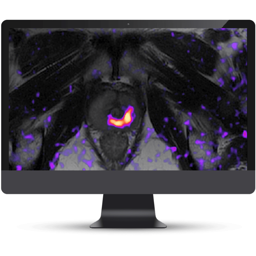 Olea Medical-Cardiology, Kryptonite solutions