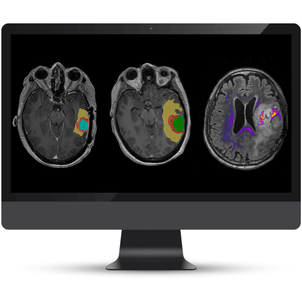 Olea Medical-Cardiology, Kryptonite solutions