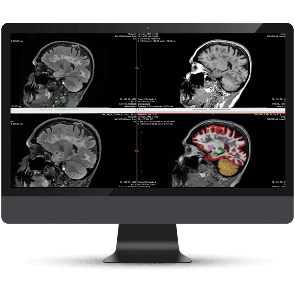 Olea Medical-Cardiology, Kryptonite solutions