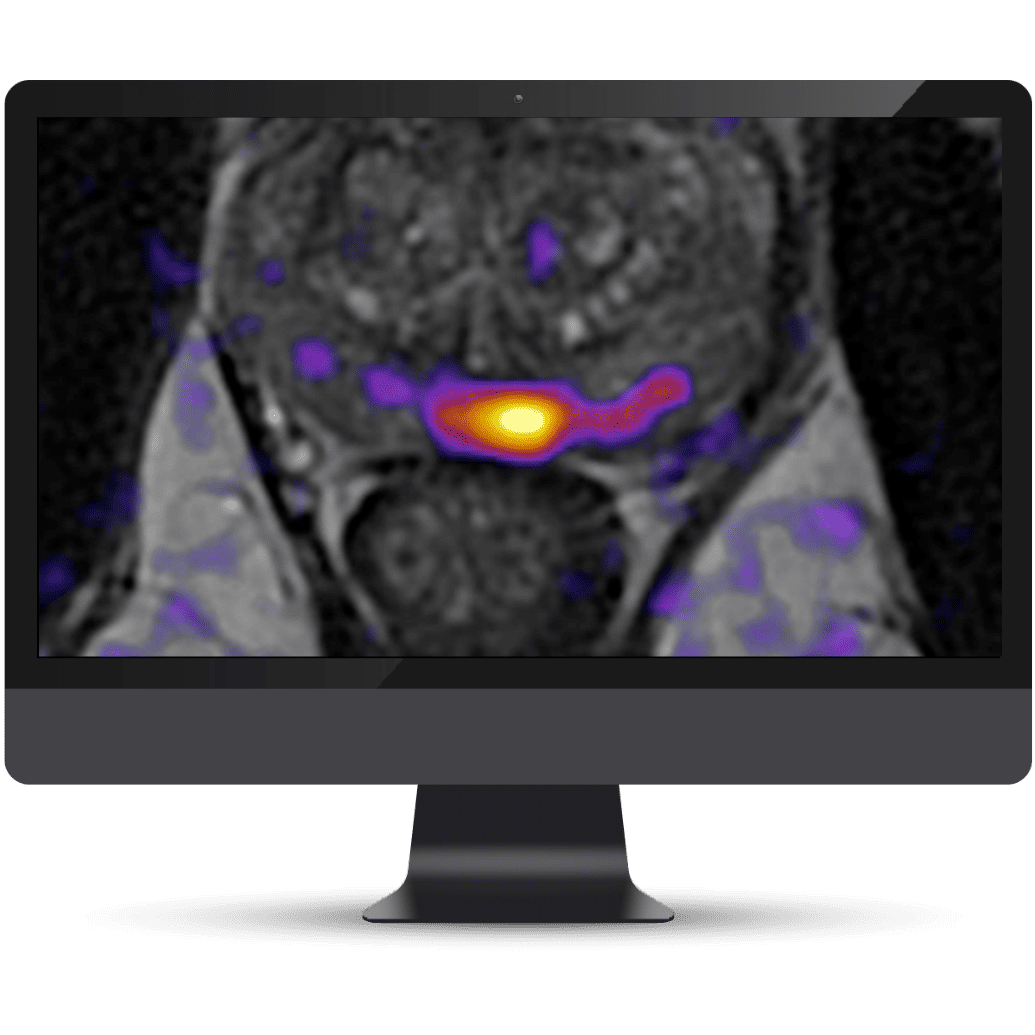 Olea Medical-Cardiology, Kryptonite solutions