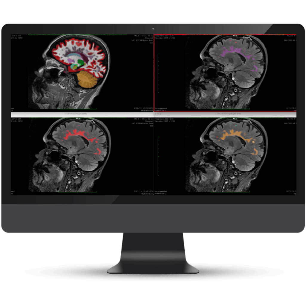 Olea Medical-Cardiology, Kryptonite solutions