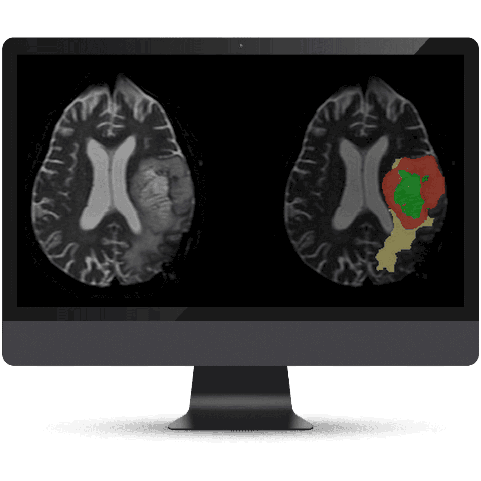 Olea Medical-Cardiology, Kryptonite solutions